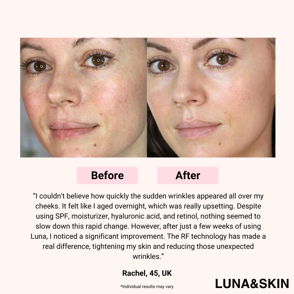 LUNA&SKIN Booster Pro™