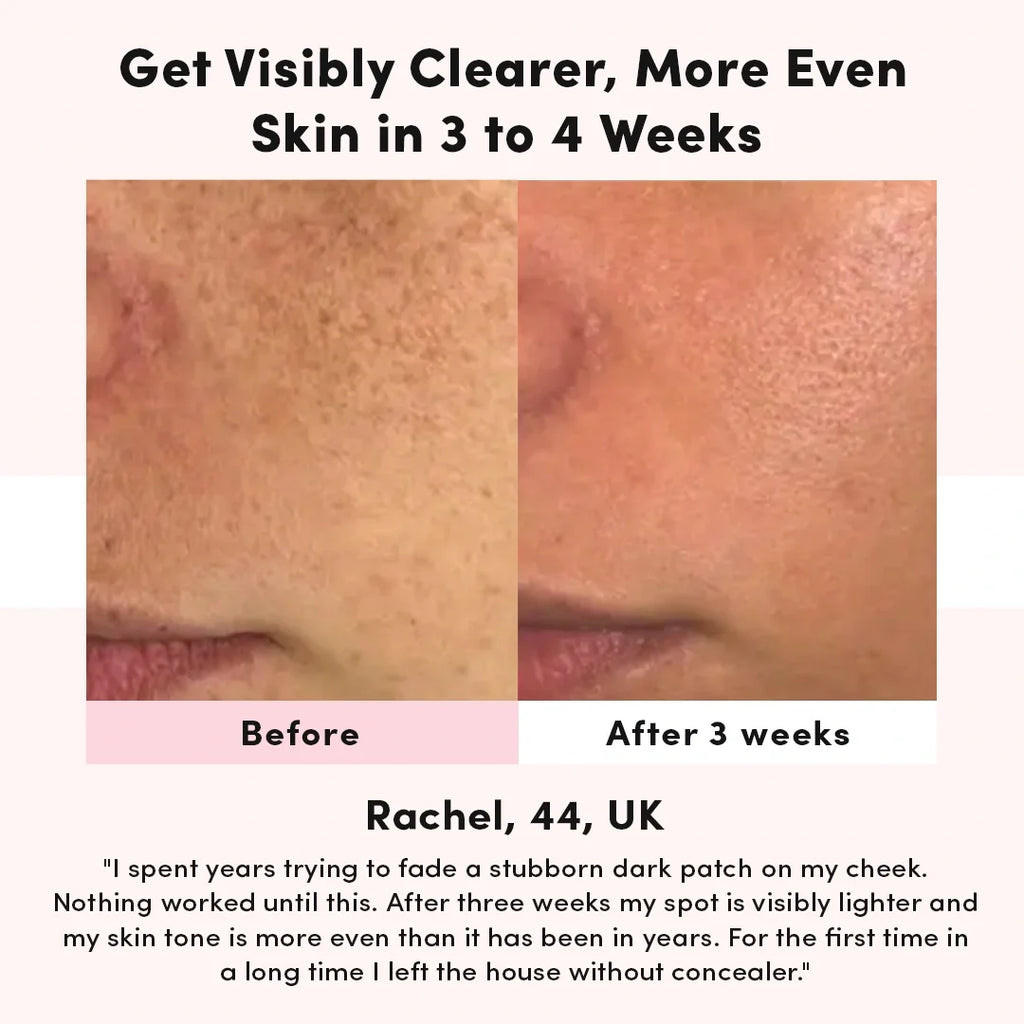 LUNA&SKIN RegenMask™