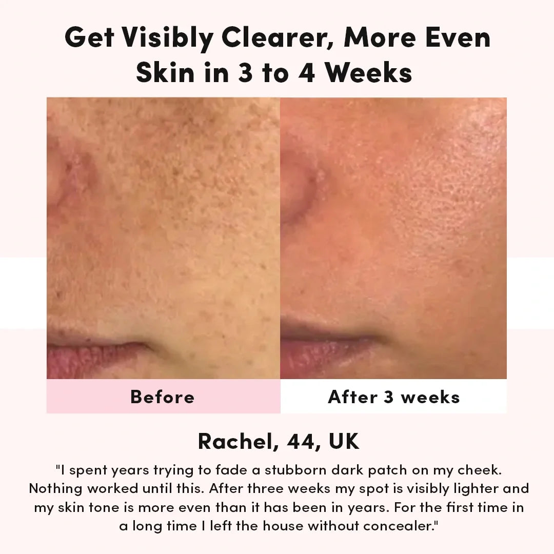 LUNA&SKIN RegenMask™