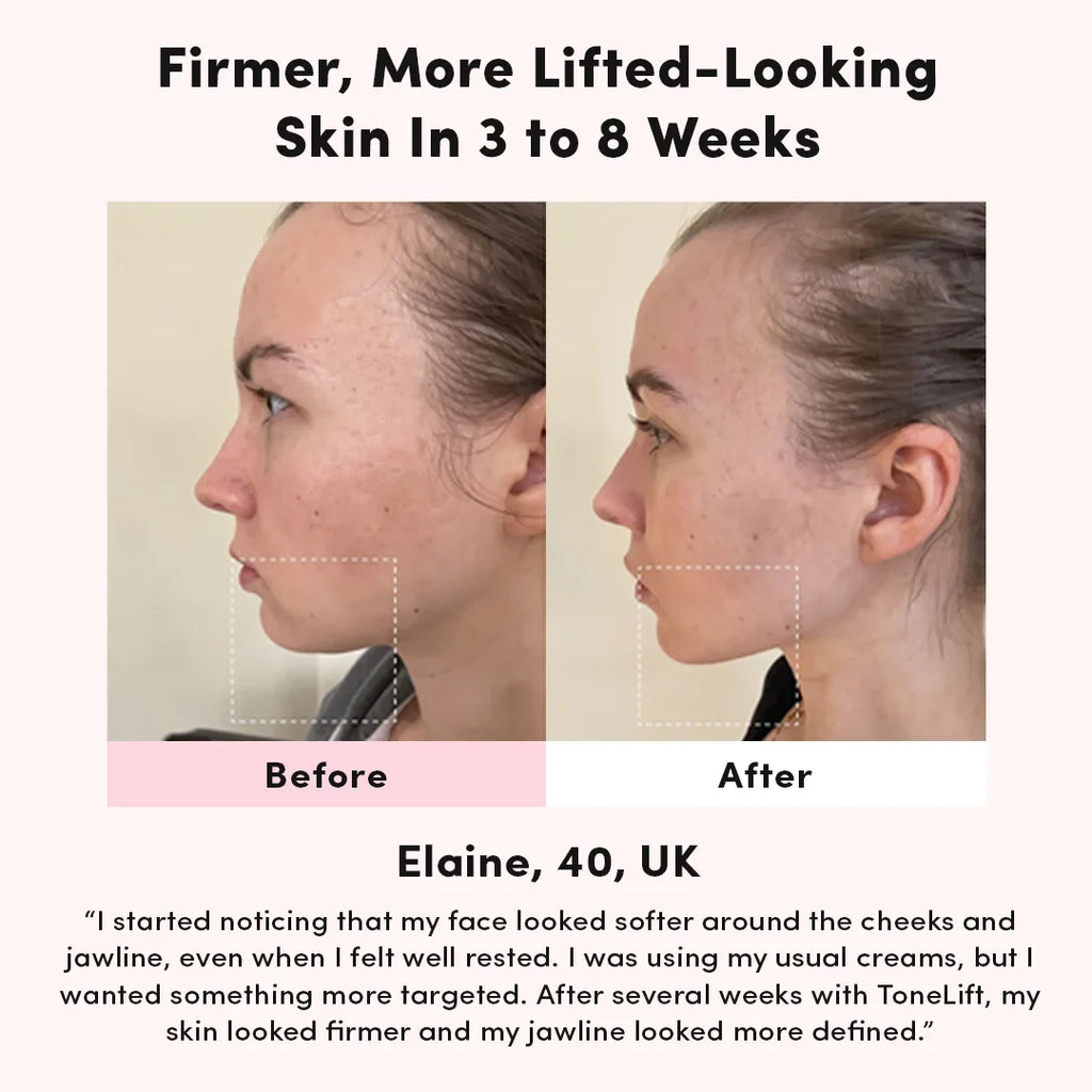LUNA&SKIN ToneLift™