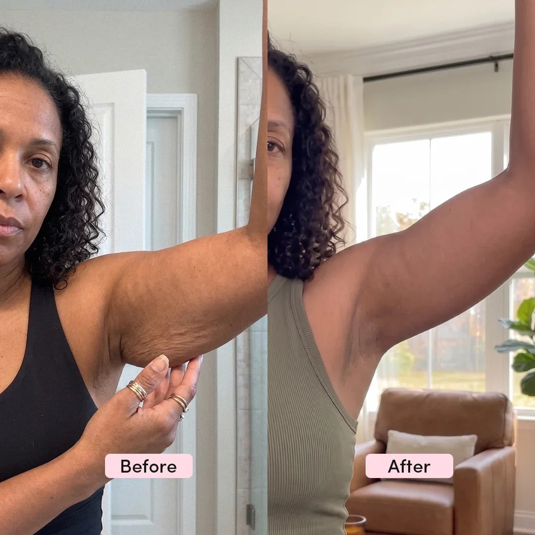 LumiSculpt™ 3-in-1 Body Sculptor