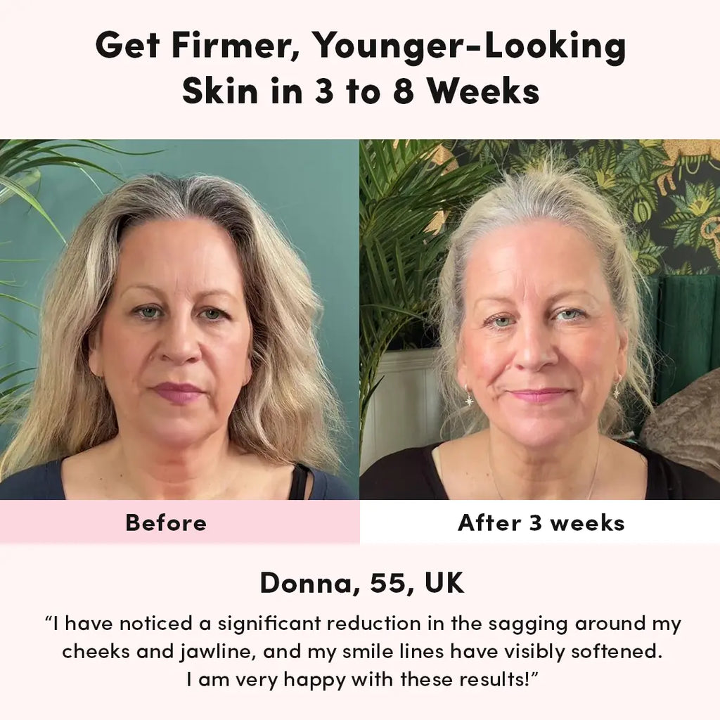 LUNA&SKIN RegenMask™