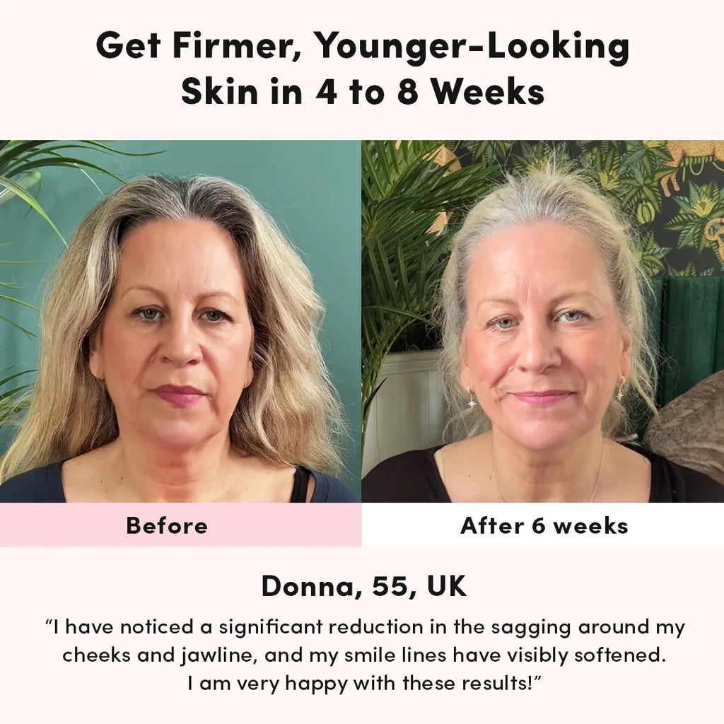 LUNA&SKIN RegenMask™